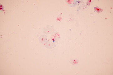 Characteristics of anatomy and Histological sample Squamous epithelial cells under microscope, Human and isolated Cell.
