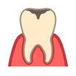 歯茎と虫歯	