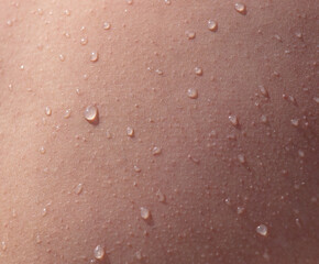 Water drops on human skin as an abstract background.