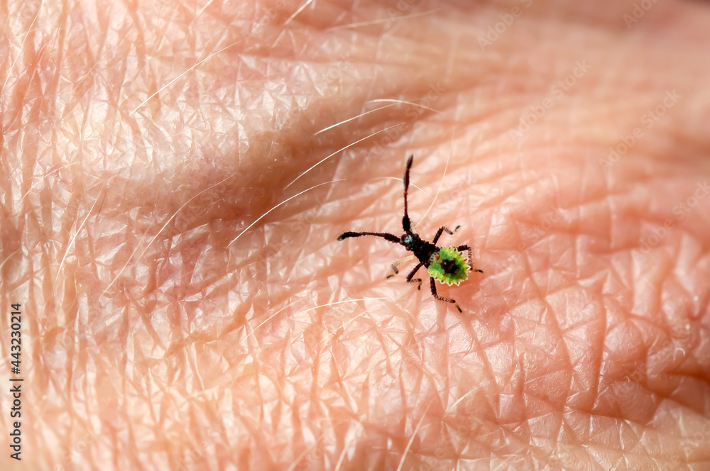 Coreus marginatus, Dock Leaf Bug or Brown Squash Bug on skin, hand ...