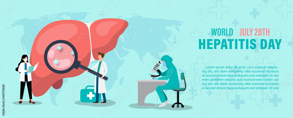 Concept of hepatitis A, B, C, D, and world hepatitis day campaign's poster with doctors treat the liver in flat style and banner vector design. - obrazy, fototapety, plakaty 