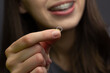 © Anna - Closeup of a woman with braces wearing orthodontic elastics to correct her bite.