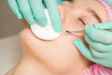 The beautician removes blackhead and acne on the female face in a beauty salon, blackhead removal tool