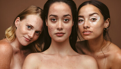 Wall Mural - close up of women with diverse skin types.