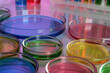 © New Africa - Petri dishes with different colorful samples on table, closeup