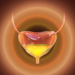 Poster - Overactive urinary bladder, 3D illustration