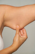 © vladimirfloyd - a woman pinches and shows the fat on her hands