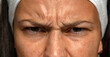  frowning woman with wrinkles on her forehead