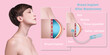 © Solarisys - Plastic surgery of breast implants