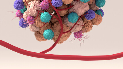 Wall Mural - Tumor microenvironment, normal cells, molecules, and blood vessels that surround and feed a tumor cell. Microenvironment can affect how a tumor grows and spreads.