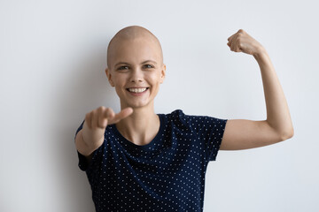 cheerful young hairless after chemotherapy ill woman pointing finger at camera, showing strong muscl