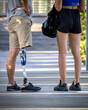 Man with prosthetic leg walking with his girlfriend. Close-up of a disabled person's leg with a prosthetic leg after amputation.