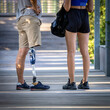 Man with prosthetic leg walking with his girlfriend. Close-up of a disabled person's leg with a prosthetic leg after amputation.
