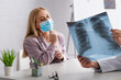© LIGHTFIELD STUDIOS - worried woman in medical mask looking at lungs x-ray in hands of physician in clinic