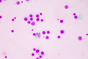 Poster - Chromosomes Human under the microscope for education.
