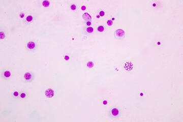 Poster - Chromosomes Human under the microscope for education.
