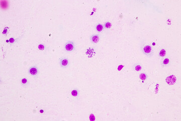 Poster - Chromosomes Human under the microscope for education.
