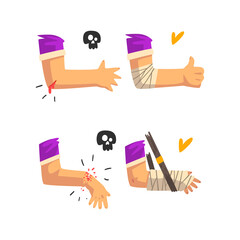 Sticker - First Aid for Wounded Bloody Elbow and Arm Fracture Vector Set