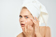 © SHOTPRIME STUDIO - pretty woman with a towel on her head skin problems dermatology