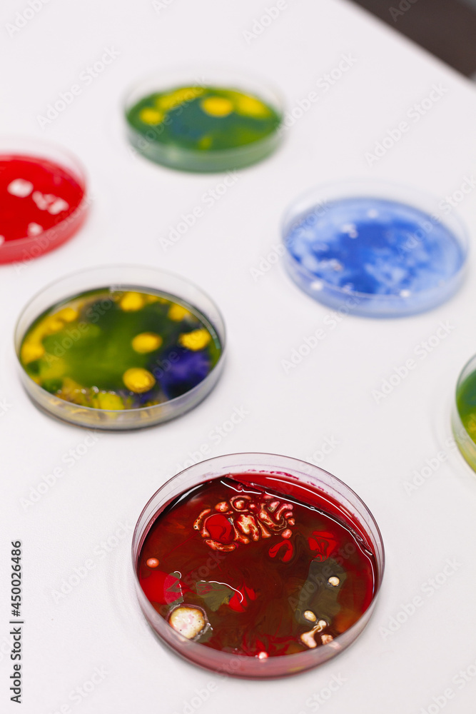 Petri dish with colony of microorganism standing on table in ...