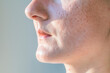 Acne scars on a woman is face close-up.
