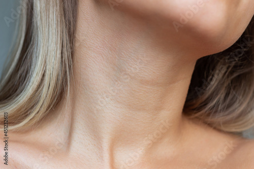 A close-up view of a young woman\'s neck and collarbone . Lines on the neck. Wrinkles, age-related changes, rings of Venus, goosebumps. Skin care. Close-up