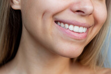 Cropped Shot Of A Face Of A Young Caucasian Smiling Blonde Woman With Dimples On Her Cheeks. Close-up Of A Blonde Girl With Even White Teeth. Dentistry Concept