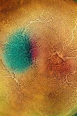 Poster - The surface of biological tissue infected with pathogenic microorganisms