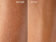 Dry skin before and after moisturizing treatment