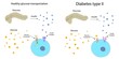 © Science RF - Diabetes type 2 and healthy glucose metabolism, illustration