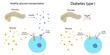 © Science RF - Diabetes type 1 and healthy glucose metabolism, illustration