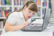 Girl with syndrome down uses a laptop at school. Education for disabled children concept