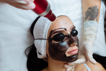 Wall Mural - Close-up of cosmetologist's hand making hardware carbon peeling by young pretty customer woman in safety glasses headdress lying on couch in beauty salon. Facial cleaning concept. Cosmetology Services