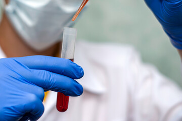 a medical worker in a white coat and blue gloves draws blood from a test tube with a pipette for analysis