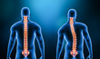 Comparison between normal backbone and scoliosis curvature of the spine with male model from back view 3D rendering illustration. Human anatomy, spinal deformity, backbone pathology, medical concepts.