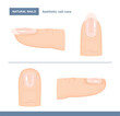 Different Types of Fingernails. Aesthetic Nail Care. Vector Illustration