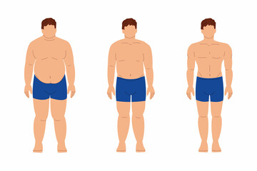 Weight loss stages. Fat obese man is losing weight. Slimming. Stock vector flat cartoon illustration infographics on a white background.