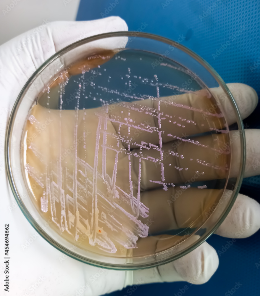 Gnr Rodding Stools E coli colonies, Gram negative Rods, GNR colonies as test on Salmonella ...