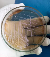 Canvas Print - E coli colonies, Gram negative Rods, GNR colonies as test on Salmonella Shigella (SS) Agar plate, Stool sample