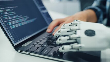 Poster - Close-up on Hands: Programmer With Disability Using Prosthetic Arm to Work on Computer Keyboard. Specialist Swift and Natural Use of Myoelectric Bionic Hand To Type Code for Software at Night