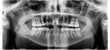 © Irina Polonina/Stocksy - X-ray dental image.