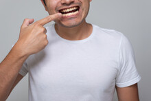 Hispanic-looking Mexican Man With Yellow Teeth, Chinese-haired Young Man In White Shirt With Gray Background Back, Points His Finger To His Mouth