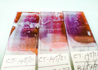 Poster - Close view of Cytopathology slides stained with Pap's stain, displayed and ready for microscopy with selective focus on slides, Histology