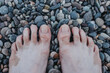 Men bare feet on wet beach pebbles - age spots on the skin after sea sunburn