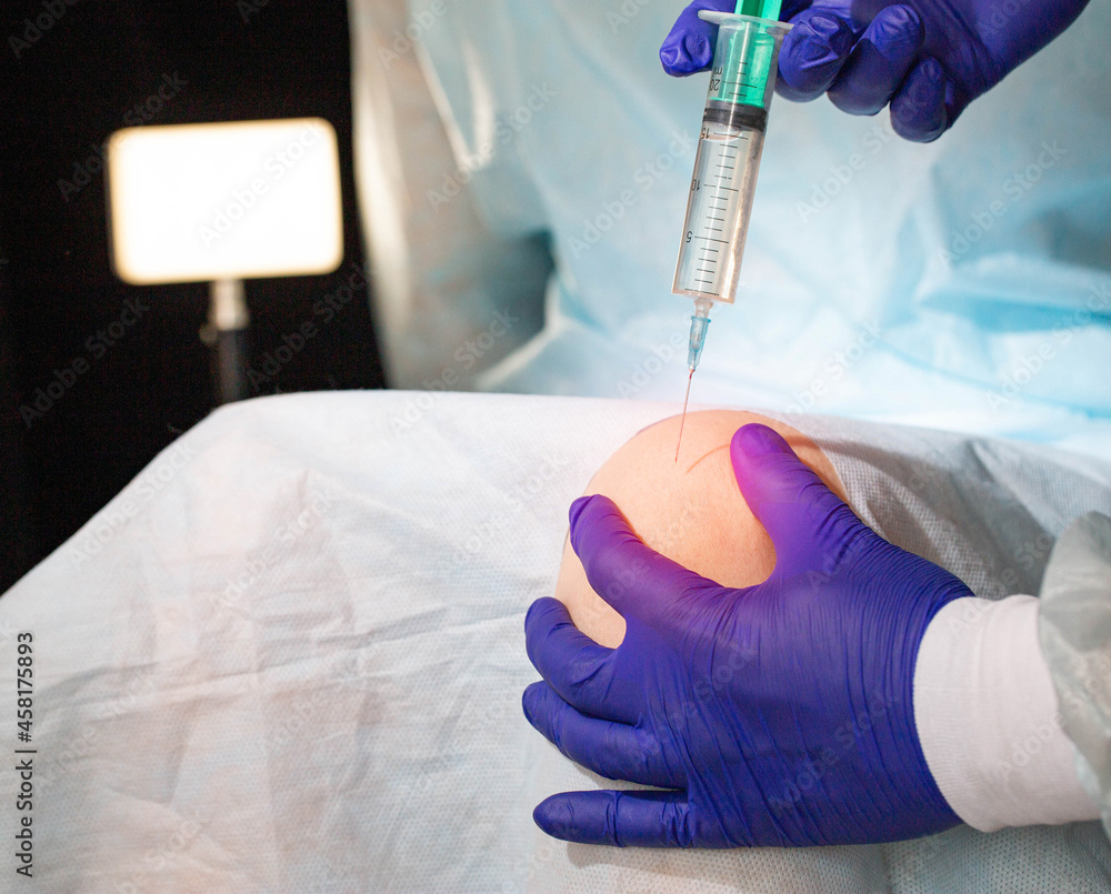 The doctor makes a therapeutic intra-articular injection into the knee ...