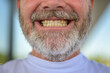 © michaelheim - Close up on the teeth and chin of a senior bearded man