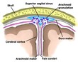 The illustration demonstrated the pathwway of cerebral venous drainage.