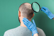 Trichologist examines the area of baldness on the client's head with a magnifying glass. Back view. Green background. The concept of alopecia and aesthetic medicine