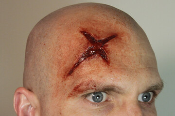 Fototapeta male with head wound #2
