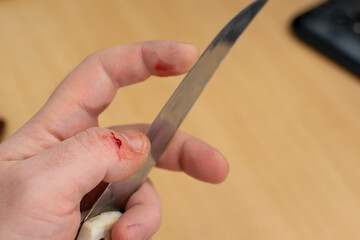 close up, a blood clot on the finger of a man who is holding a knife in his hand, which he just accidentally cut himself with